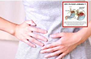 ASAM LAMBUNG JANGAN DIANGGAP REMEH