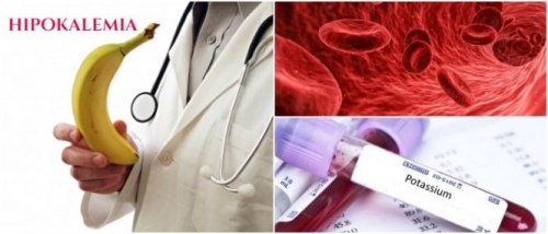HIPOKLEMIA?? TAK KENAL TAK SEHAT